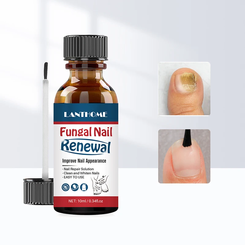 

Effective Fungal Nail Treatment Serum Onychomycosis Paronychia Anti-Fungal Nail Infection Herbal Toe Fungus Repair Essence Care