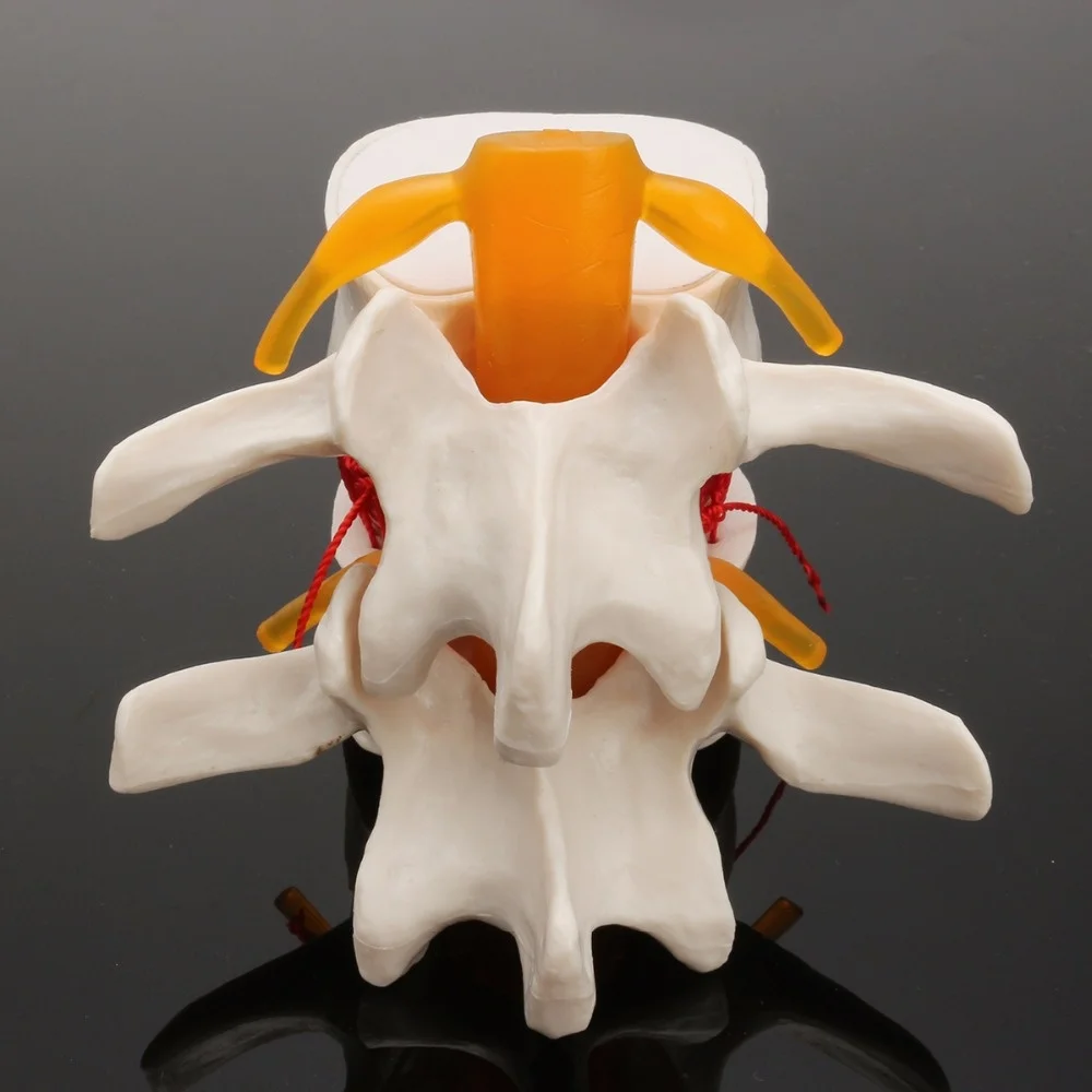 

Spine skeleton Human anatomy Lumbar Disc Herniation Teaching Model brain skull traumatic pistol school supplies medical instrume