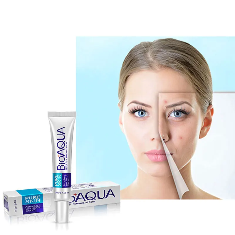 

BIOAQUA Acne Removal Cream Gel Anti-Acne Scar Treatment Skin Care Face Whitening Cream Moisturizing Oil Control Acne Remover 30g