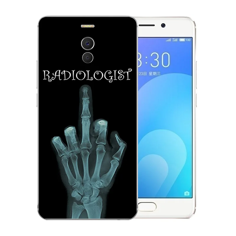 Прозрачный Роскошный чехол для телефона Meizu M6 M5 Note Mini MX6 15 Lite X8 U10 мягкий из ТПУ с