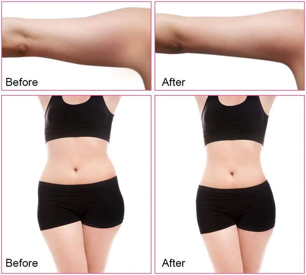 40k антицеллюлитный аппарат RF отрицательная машина для похудения тела устройство