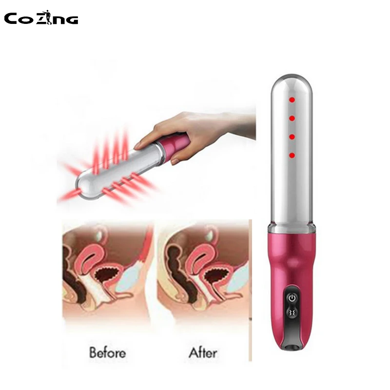 

Gynecological Laser Therapy Wand Vaginal Tightening Wand Vaginal Rejuvenation Machine Vaginitis Home Remedies