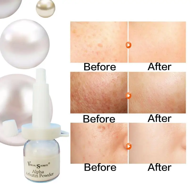 1 шт. отбеливающий крем для лица с экстрактом арбутина|Отбеливание зубов| |