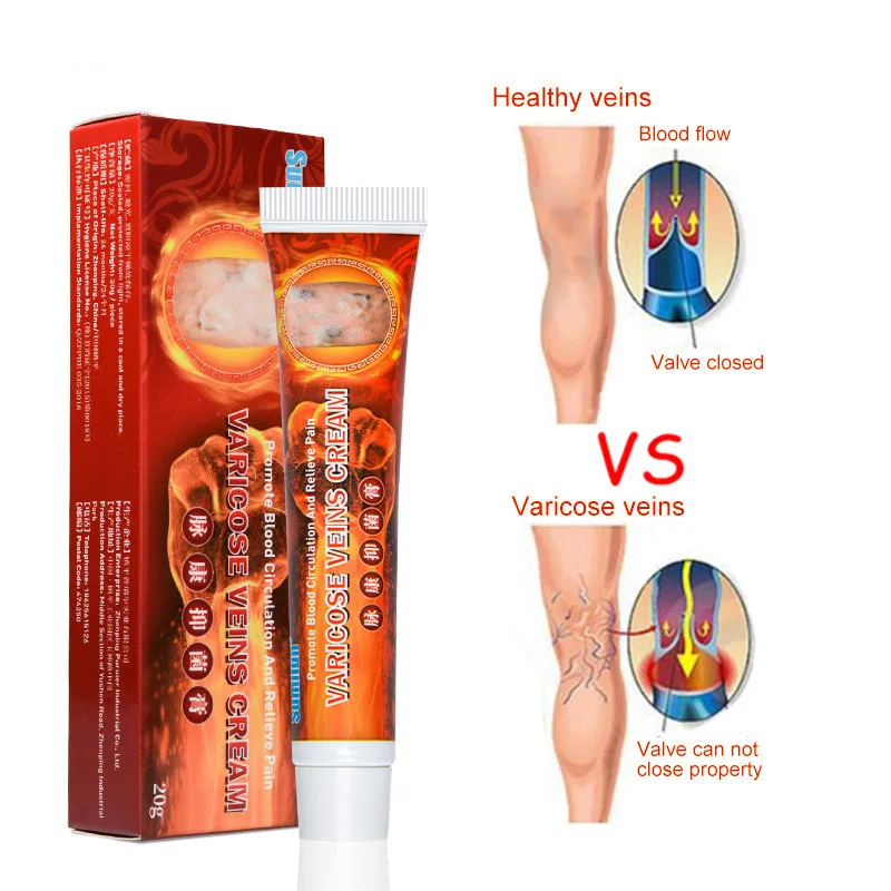

Varicose Veins Ointmnet Vasculitis Phlebitis Spider Cream Varicosity Angiitis Removal Herbal Medical Plaster
