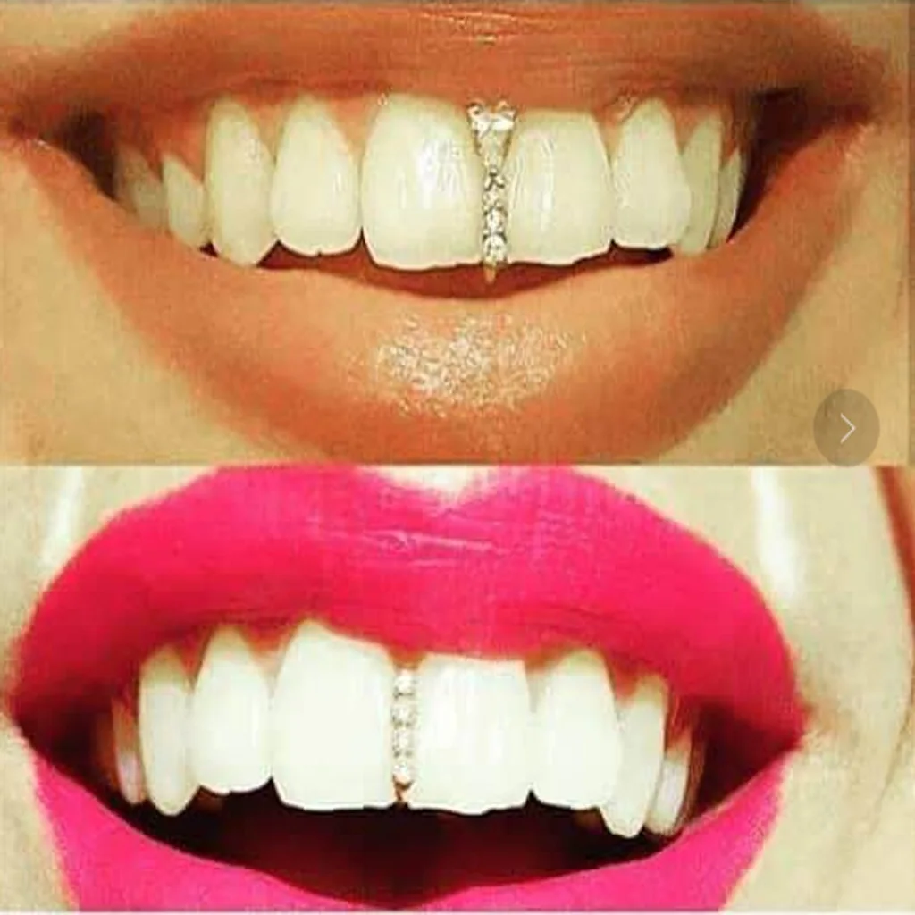 

2021 New Hip Hop Gold Teeth Grillz Top Crystal Grills Dental Mouth Punk Teeth Caps Cosplay Party Tooth Rapper Funny Jewelry Gift