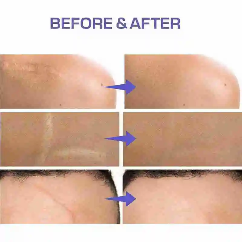 

Tattoo Flaw Conceal Tape Full Cover Concealer Sticker Type Tape Flaw For Any Suitable Concealing Scar Skin Waterproof Cover F8V6