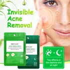 22 шт., пластыри от прыщей и чёрных точек