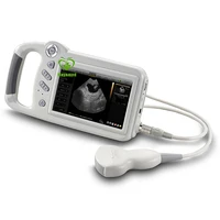 my a015e 7 inch touch screen digital frequency scan portable ultrasound scanner machine
