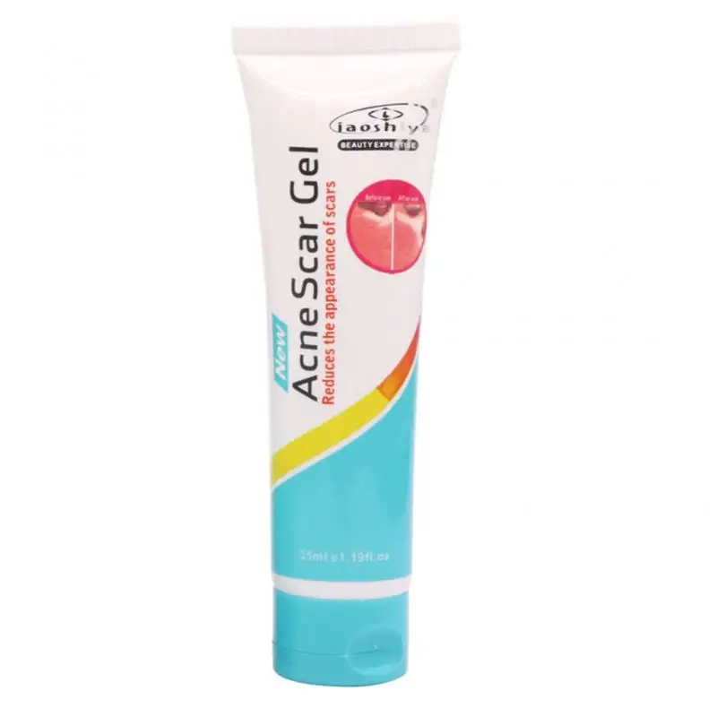 Authentic Acne Treatment Cream Anti Acnes Cream Scar Removal Cleansing Gel Pimple Shrink Pore Fade Acne Mark For Face Skin Care
