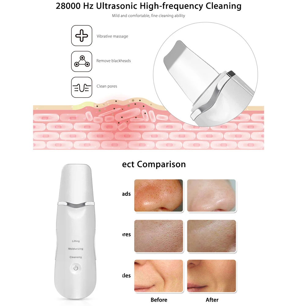 

Ultrasonic Skin Scrubber Deep Face Cleaning Machine Peeling Shovel Facial Pore Cleaner Skin Scrubber Lift Machine SPA Spatula