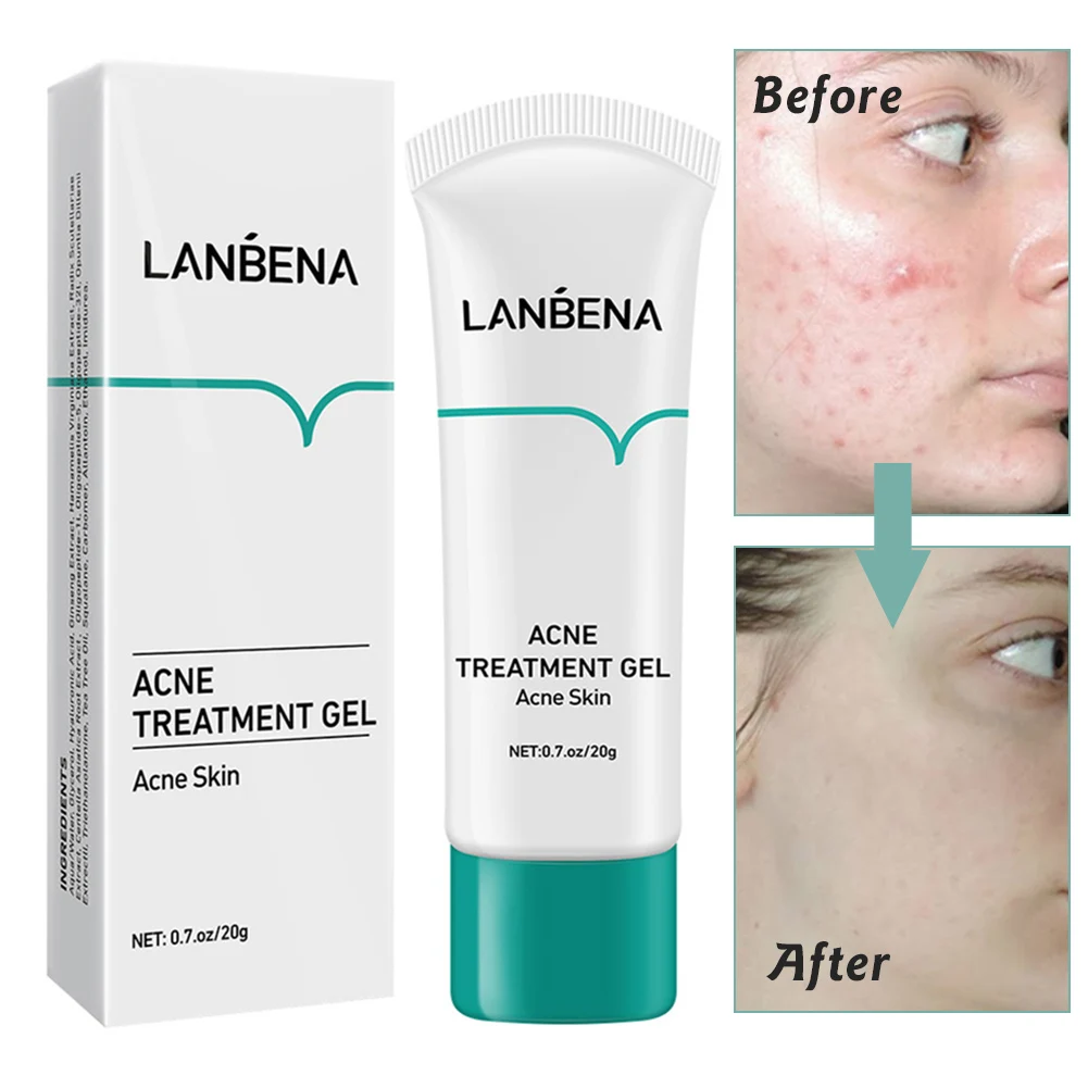 

Treatment Whitening Cream Blackhead Repair Gel Oil Control Shrink Pore Scars Moisturizing Skin Skin Care Korea
