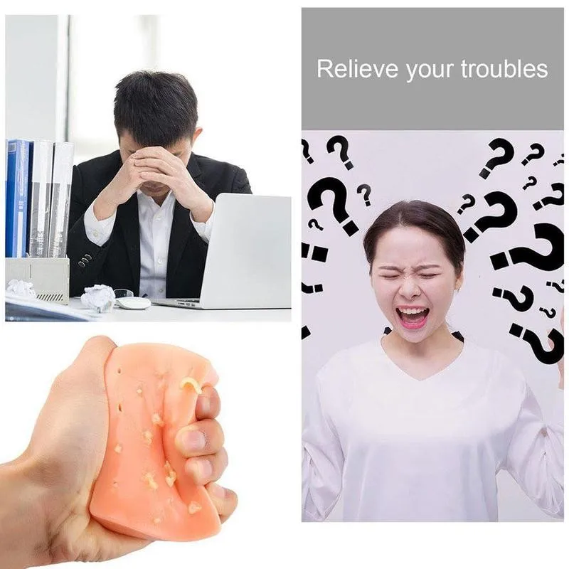 

Acne Squeeze Toys Stress Relief Peach Pimple Popping Stress Reliever Popper Remover Decompress Vent Toys