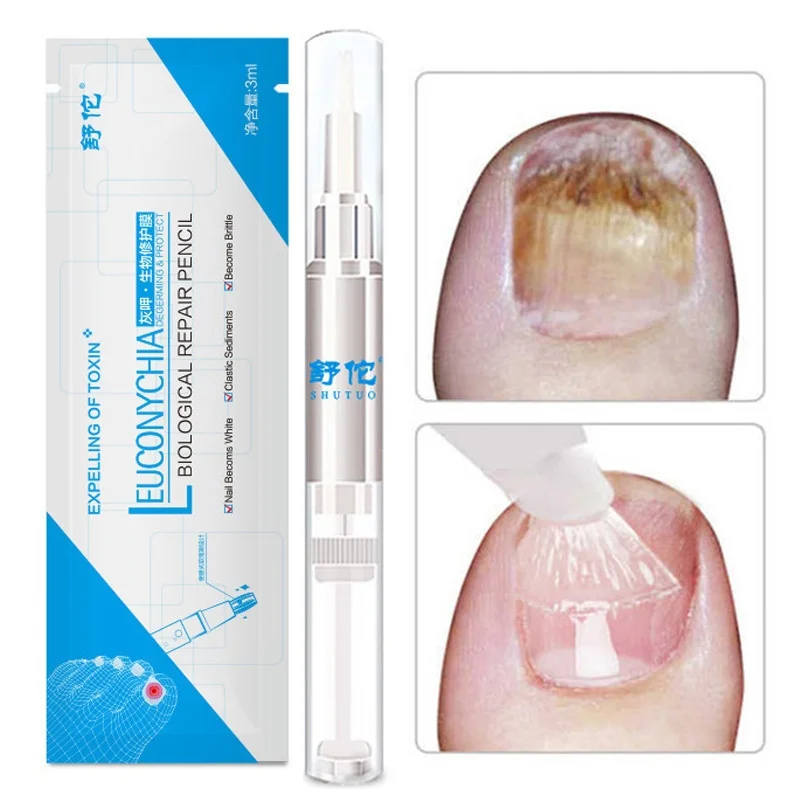

3ml No Irritation Anti Fungus Nail Liquid Nail Cell Regeneration Pen Onychomycosis Paronychia Gentle Ingredients TSLM1