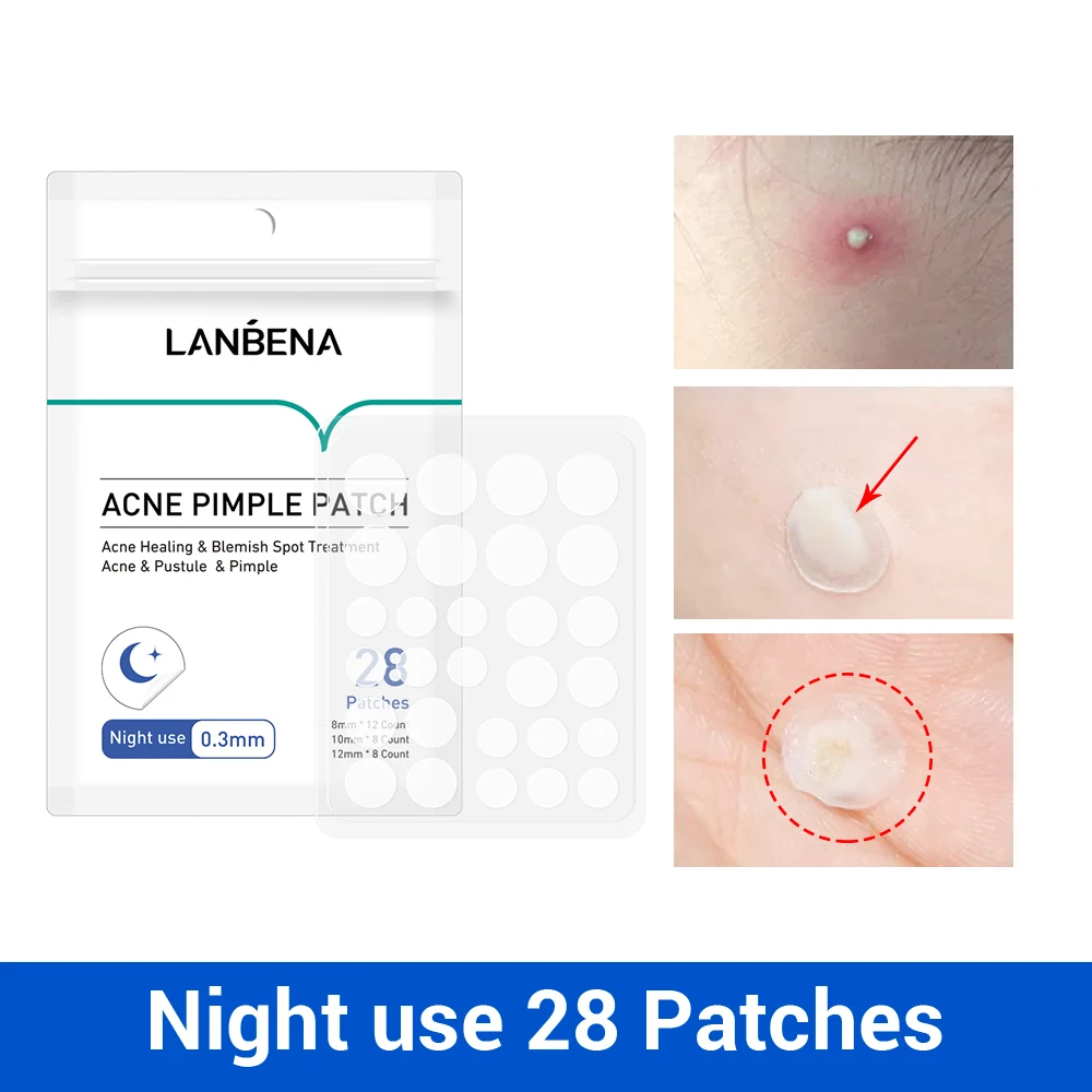 

LANBENA New Acne Treatment Set Face Skin Care Acne Removal Repair Kit Shrink Pores Cleansing Cleanser + Acne Gel + Acne Patch