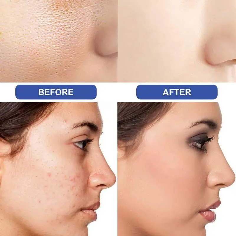 Goat Milk Sea Salt Soap Remove Pimple Pores Acne Treatment Base Tools Wash Care Cleanser Soap Face Moisturizing Skin C5Y2