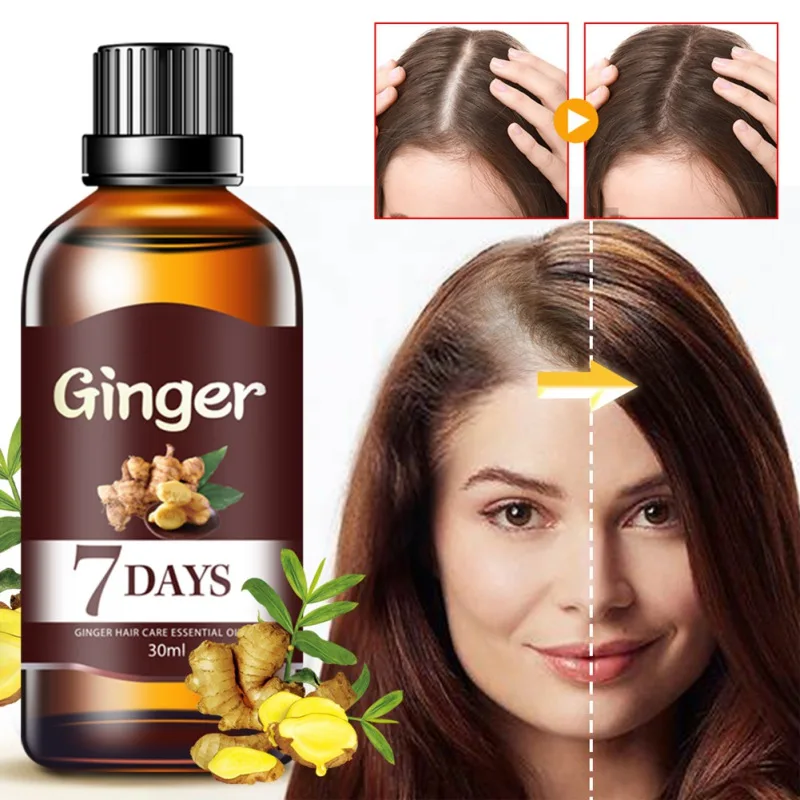 

30ML 7 Days Fast Hair Growth Essence Oil Ginger Hair Growth Serum Nourishing Soften Treatment Hair Loss Repair Damaged Hair