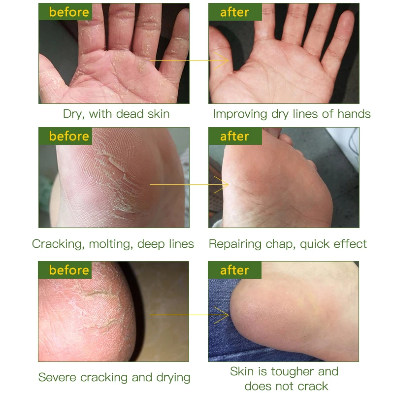 Конское масло крем для рук пятки пилинг ног восстанавливающий против сухой