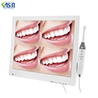 17-дюймовый экран, стоматологическая внутриоральная камера с монитором, цифровая фотокамера Сканнер CMOS, медицинское оборудование для полости рта