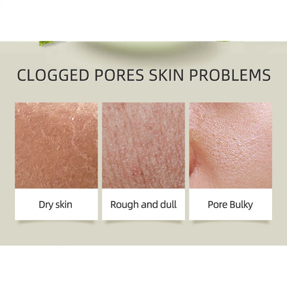 1 шт. увлажняющее средство для удаления черных точек|Скрабы и средства тела| |