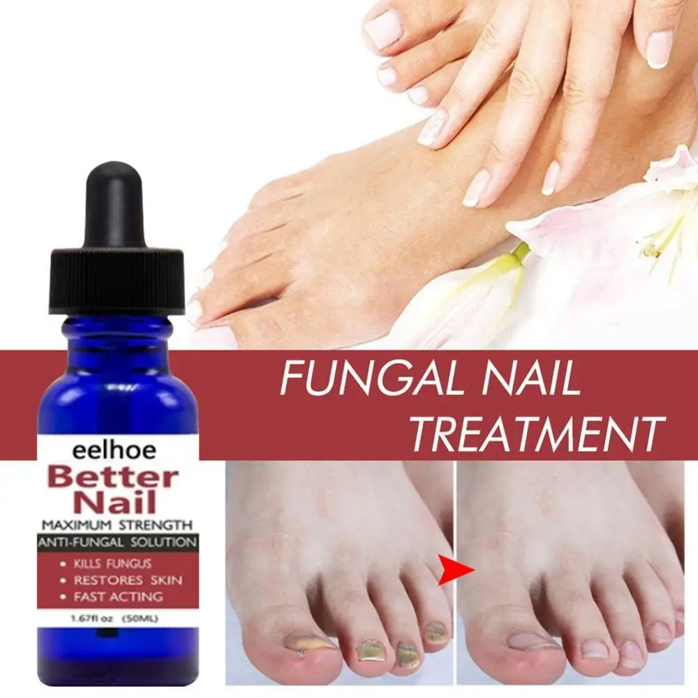 

2/1pc 12ml Nail Repair Liquid Anti Fungus Toe Serum Remove Nail Onychomycosis Essence Nail Treatment Liquid Hand Foot Care