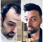 Средство для роста волос PURC, шампунь для роста волос, продукты для роста волос, предотвращает выпадение волос с Лысой, мужские и женские средства для ухода за волосами