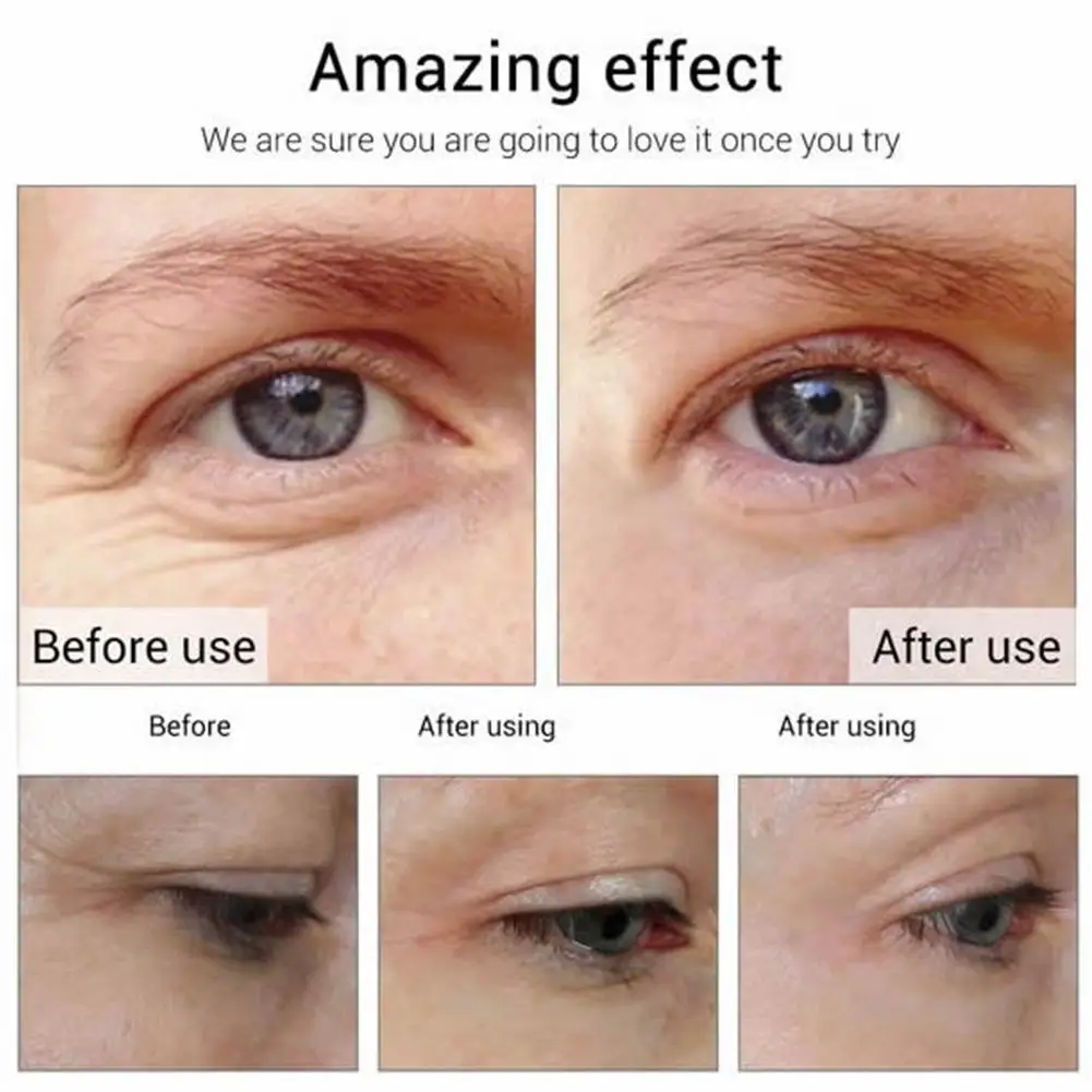 

Eye Cream Hyaluronic Acid Serum Essence Gel for Firming Wrinkles Whitening Puffy Eye Care 20g
