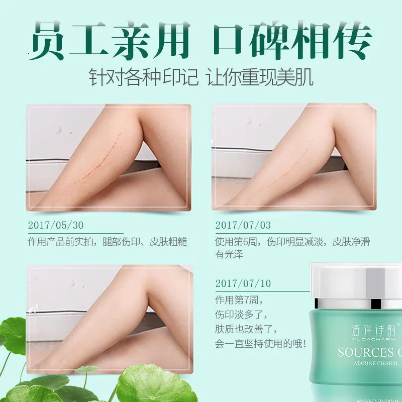 Ocean Rhyme Seaweed Shu Huo Servicing Frost Light Scar Print Damaged Brighten Skin Colour |