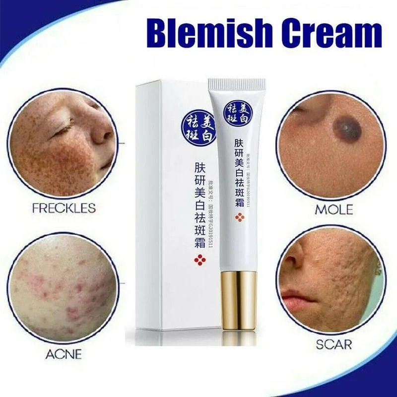 20ML Freckles Acne Pimple Scar Dark Spots Removal Face Spots Quick Cream Removal Face Whitening Use Skin Cream M5M7