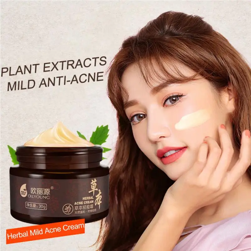 Натуральный травяной крем против акне прыщей шрамов от увлажняющий для удаления