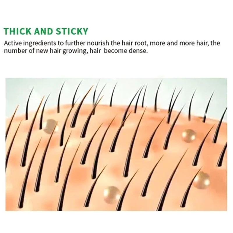 

50ml Hair Growth Serum Polygonum Extract Hair Loss Treatment Thicker Essence Oil