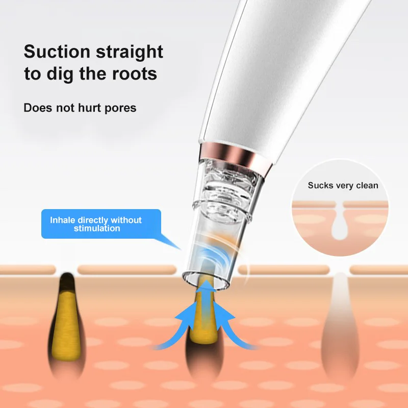 Электрический пылесос для удаления черных точек аппарат ухода за кожей лица поры