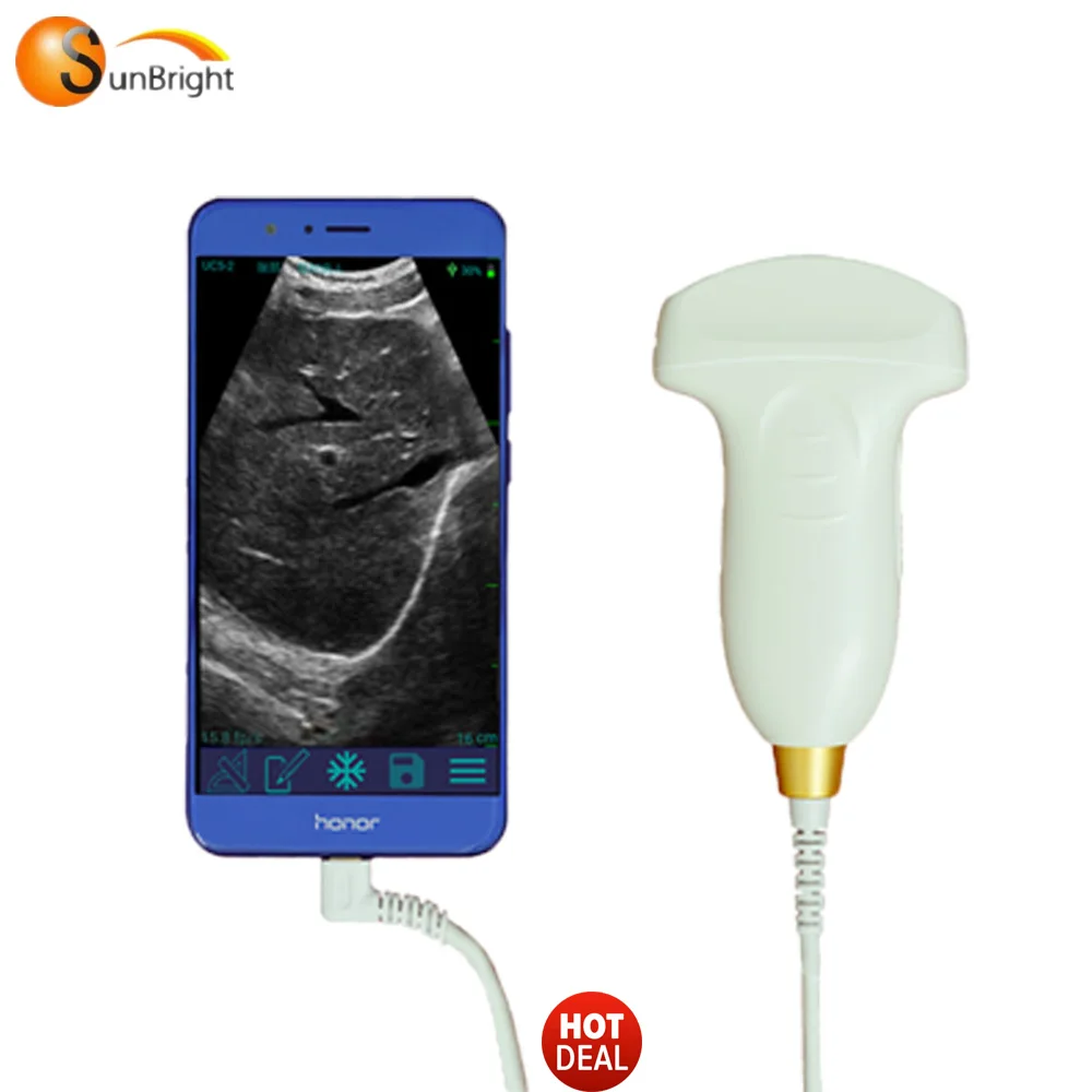 

USB Probe Ultrasound Scanner Type-C Ultrasound Convex Transducer For PC/Laptop