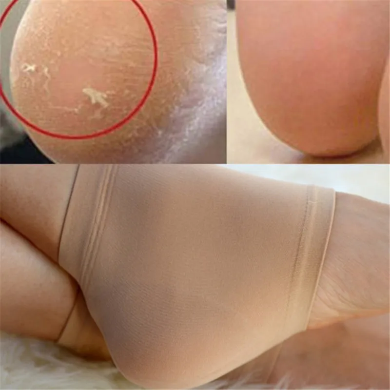

1Pair Silicone Moisturizing Gel Heel Socks Cracked Foot Skin Care Protectors Heel Pain Relief Insoles Feet Massager Tool