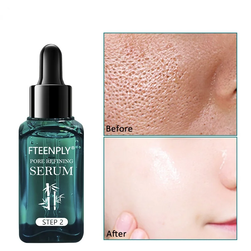 

Pore shrinking essence Facial essence skin repairing lotion shrinks pores, replenishes moisture, whitens and repairs the skin