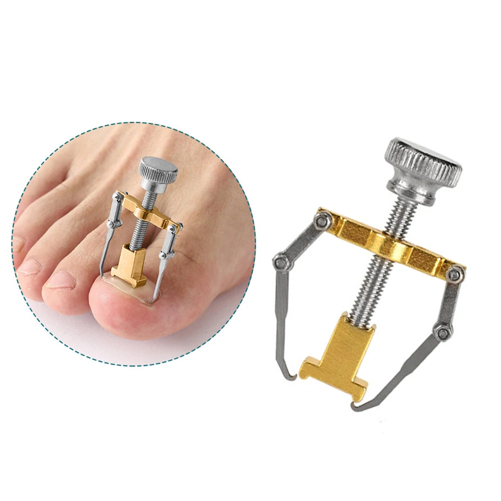 

Ingrown Toenail Toe Fixer Recover Correction Device Pedicure Foot Nail Care Tool Easy to Use