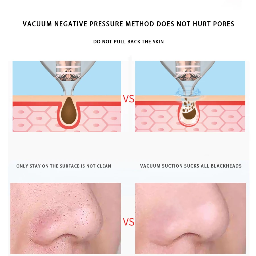 Электрический пылесос для удаления угрей и прыщей уход за кожей очищение кожи 3