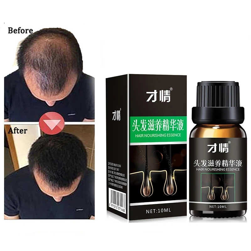 

Hair Growth Essence Professional Salon Hairstyles Keratin Hair Care Styling Products Anti Hair Loss Products Dense Sunburst Hair