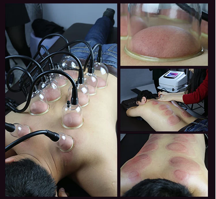 HOT SALE!!! Breast Enlargement Body shaping Vacuum Massage Therapy With Cellulite Removal Machine For Salon | Красота и здоровье