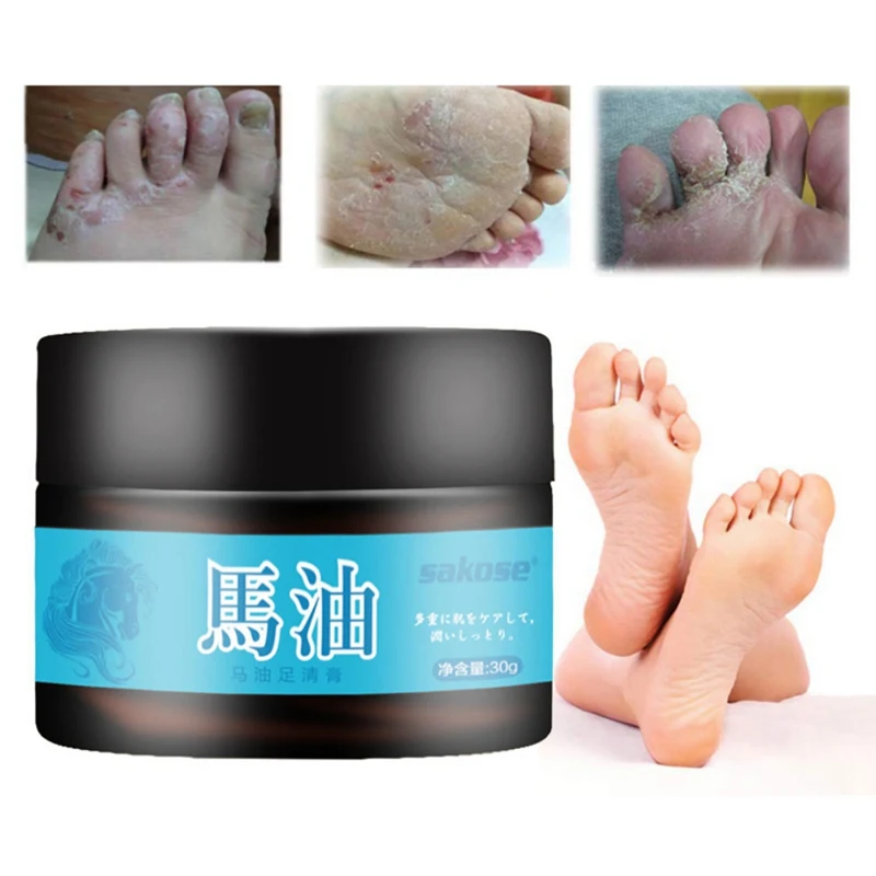Крем для ног с конским маслом удаления омертвевшей кожи спортсмен средство ухода