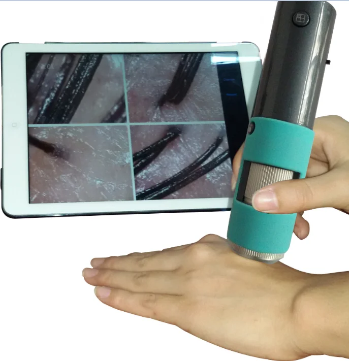 

Wireless connection phone, tablet, computer, HD scalp detector