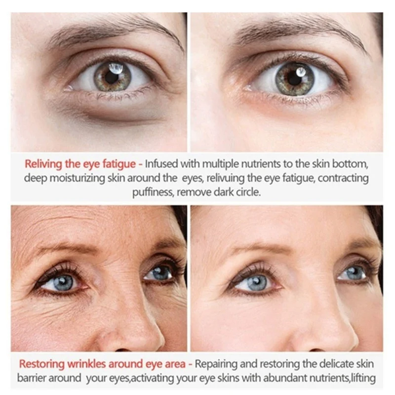

1Pc Rapid Instantly Eye Cream Remove Dark Circles Fine Lines Eye Bag Against Aging Deep Moisturizing Eye Cream Dropship