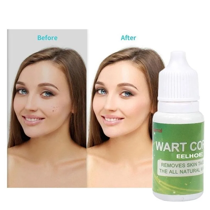 

Mole & Skin Tag Removal Treatment Warts Liquid From Cream Freckle Wart Tags Oil Removal Spot Dark Tag Removal Face Plaster Y0H1