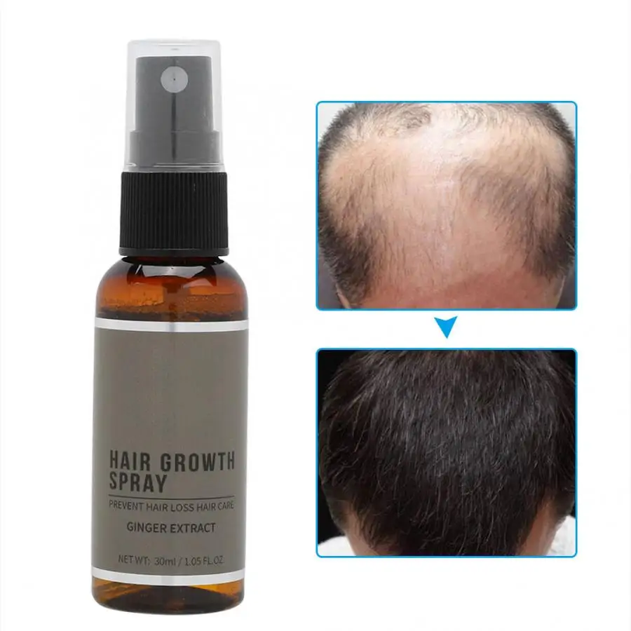 30 мл травяной экстракт спрей для роста волос лечение против выпадения жидкий