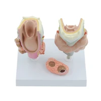 thyroid diseased model thyroid gland anatomical human anatomy medical teaching educational equipment pathologic model