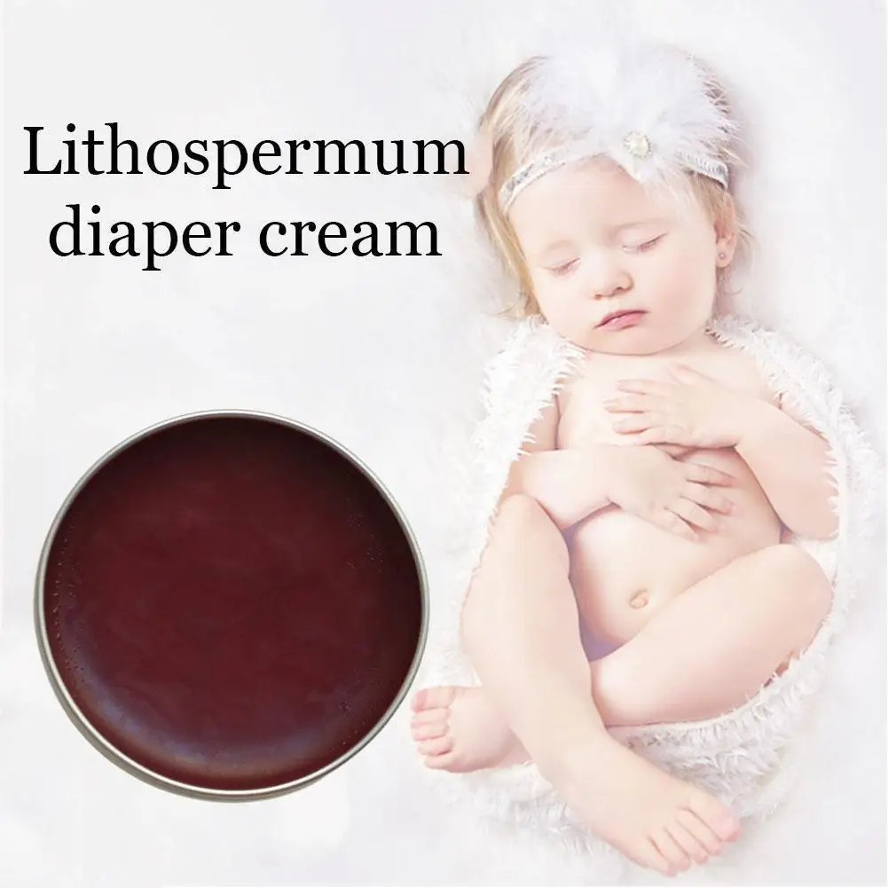 

Lithospermum Diaper Cream Inner Thigh Whitening Cream Spotless Inner Thigh Spots Remover Fast Action