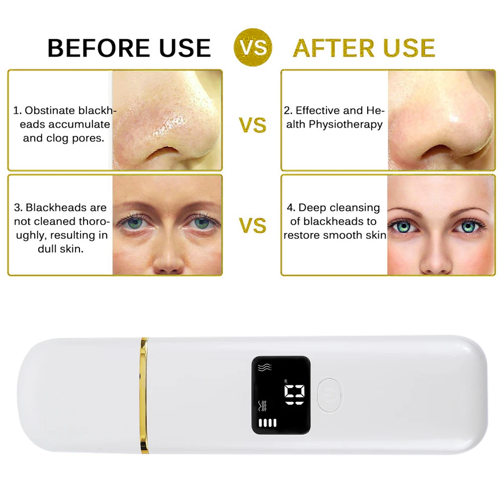 Ультразвуковой светодиодный скруббер для кожи Электрический пилинг Лопата