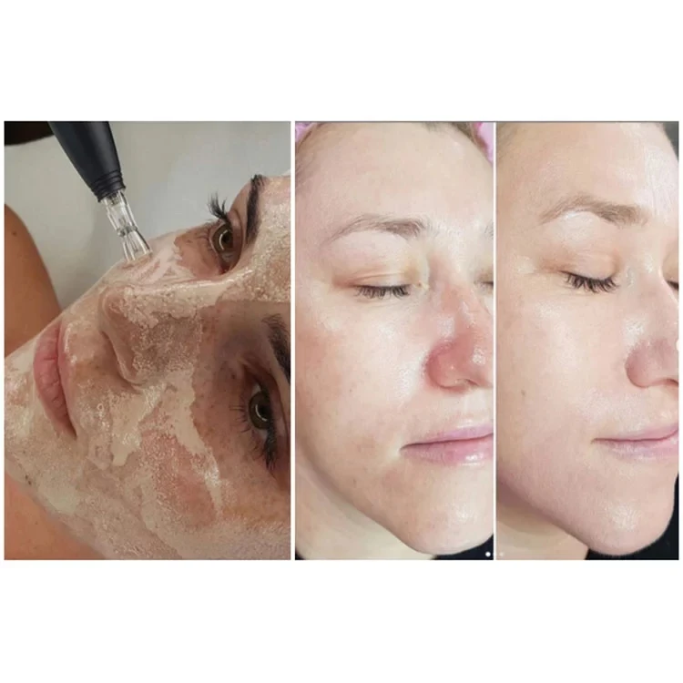 Бренд Derma White Booster BB сыворотка свечение микс стартовый набор с добавкой основы ниациamдля эффективного осветления против старения bb