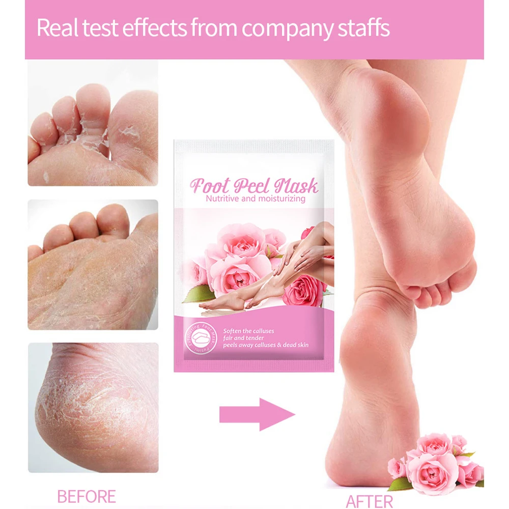 

1 пакет/2 шт. маска для удаления омертвевшей кожи ног увлажняющие нежные гладкие патчи для ног маска для очистки носков спа средство для удал...