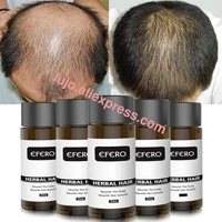 ginger extract dense hair fast sunburst hair growth essence shampoo stop hair loss treatment hair loss liquid care oil