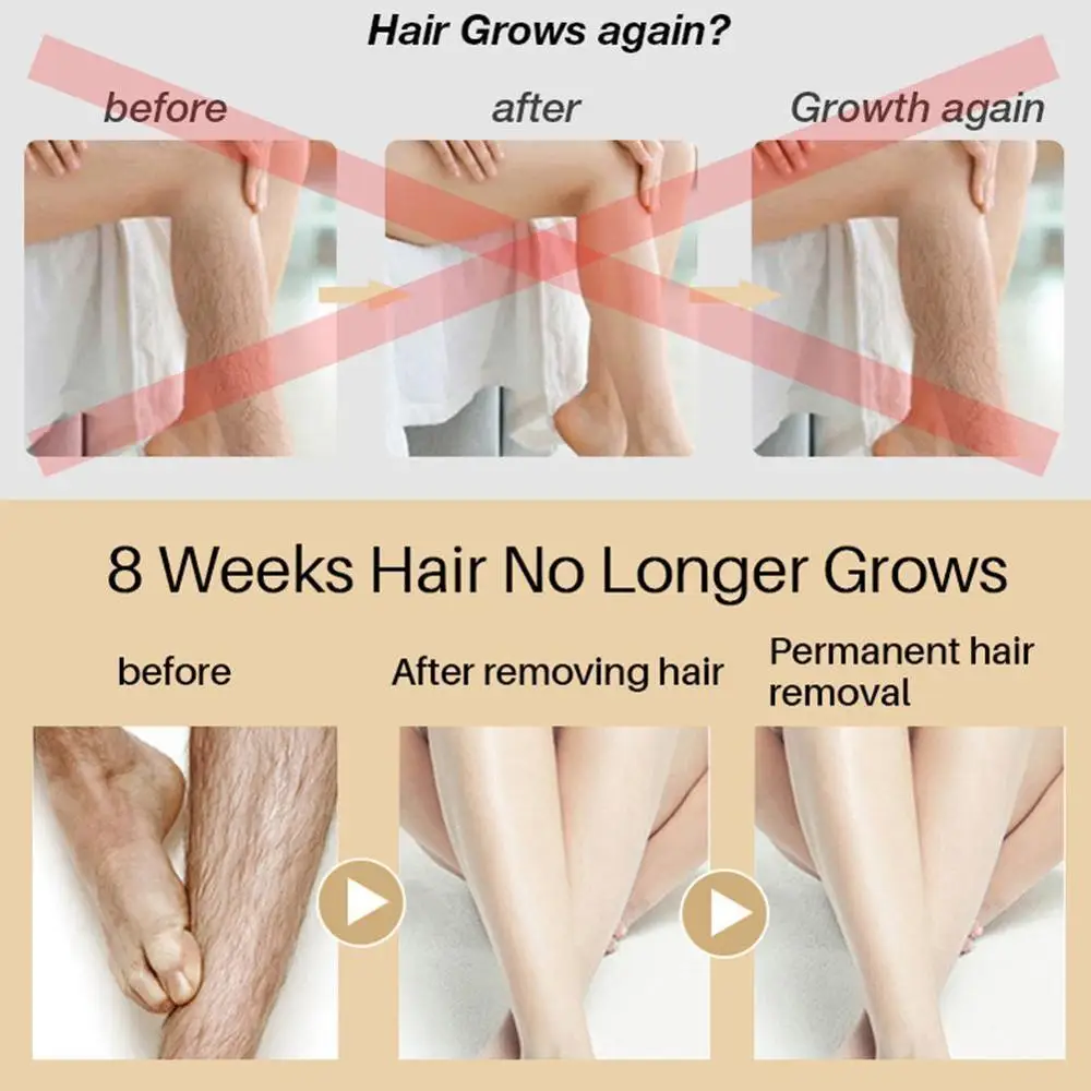 Длительное торможение роста волос Новый ингибитор спрей для стоп лица ноги тела